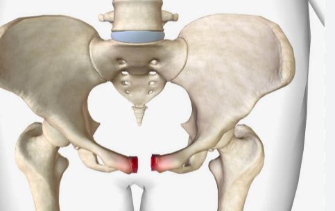 Bone Fractures: Types, Symptoms & Treatment
