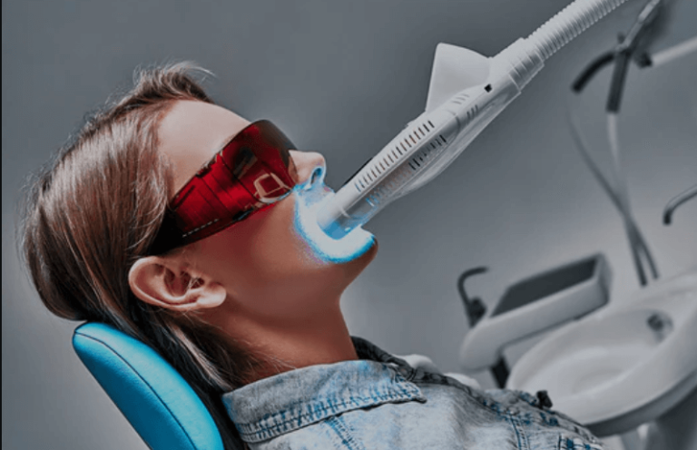 What Is Zoom Teeth Whitening and How Does It Work?