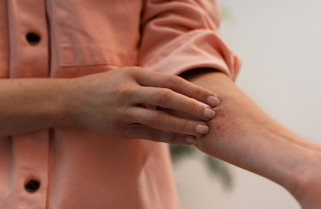 Can Collapsed Veins Heal on Their Own? Understanding Recovery and Care