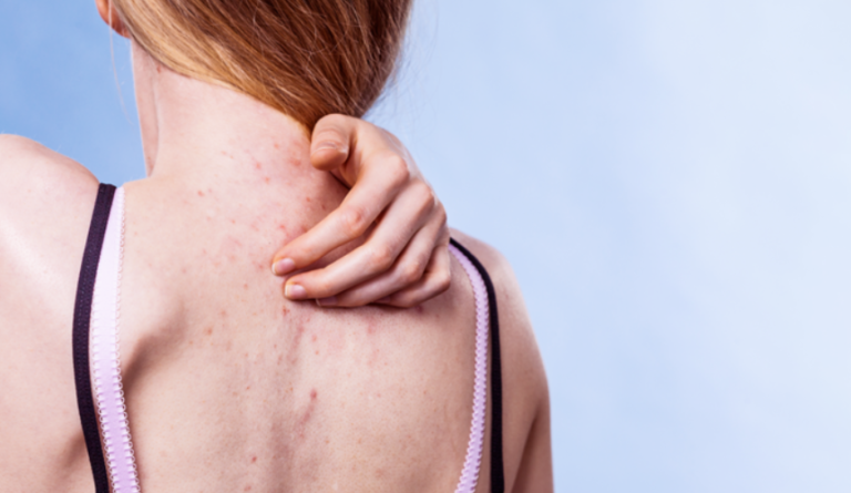 Essential Guide to Maintaining Long-Term Intimate Skin Health